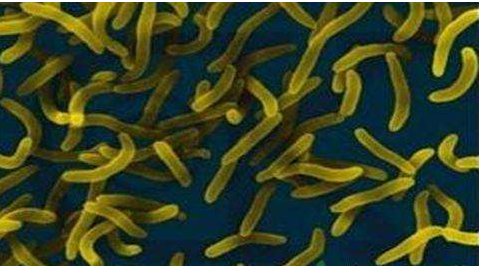 微生物菌劑好？好在哪里您知道嗎？